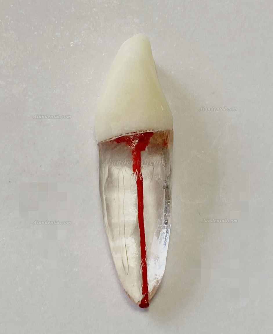 Dental Teeth Model Endo Files Practise Molar Upper Lower Tooth Premolar Root 2/3-Rooted Canal